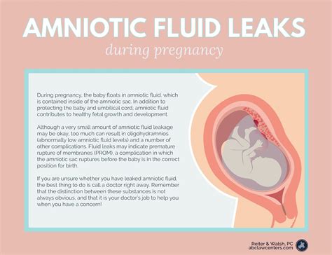 how to know if amniotic fluid is leaking|Leaking Amniotic Fluid During Pregnancy